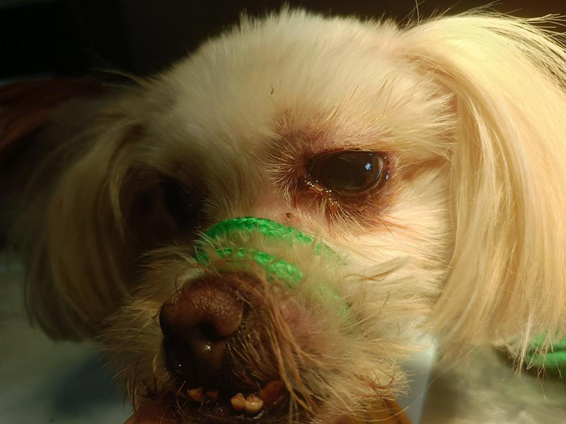 左眼櫻桃腫摘除手術(shù)